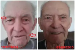 Fisioterapia Facial